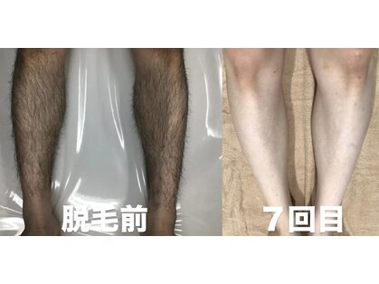 ビューティーサロンレモン(Lemon)の写真