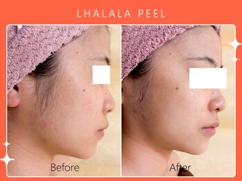 シロカネ イオンタウン西熊本店(SHIROKANE)/韓国肌管理ララピール☆