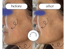 ユヌランコント 岐阜店(Une rencontre)/リフトアップ