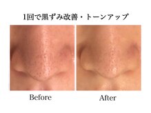 ナチュラーレ 天王寺店(Naturale)/美肌ニキビケア小顔フェイシャル