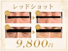 レゾン 京橋店の雰囲気（《最新韓国美容》目元のクマやたるみ取り（眼窩脂肪の分解）に◎）