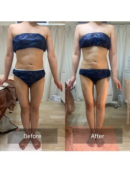 キアラ(Chiara)/痩身マシーン☆