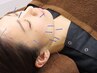 《リフトアップ・小顔に◎》美容鍼60分 ¥7,000