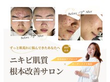 ミラリー(MIRALY)