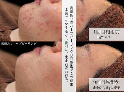 ホクビューティー(HOCU BEAUTY)の写真