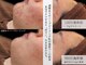 ホクビューティー(HOCU BEAUTY)の写真