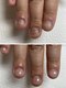 ココ ネイル サロン アンドスクール(COCO.NAIL SALON＆SCHOOL)の写真/長年の爪噛み・深爪でお悩みの方へ★お爪のトラブルはお任せ♪ケア方法もアドバイス◎何でもご相談下さい◇