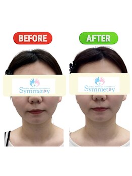 シンメトリー 熊本/自分の歪みの原因知りたいですか