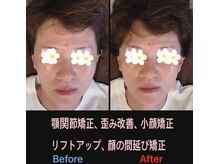 美容矯正サロン レレポノ(LELEPONO)/