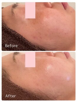 ククル(KUKULU)/ハーブ14回目♪(40代女性)