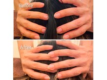 アペリラックス(ape relax)の雰囲気（頭から小さくして小顔へと導きます★[表参道/リンパ/エステ]）