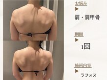 ベレガ 京都店(BELEGA)/◆BeforeAfter◆