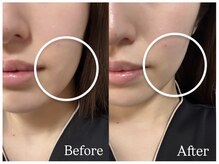 トノ(TONO)/before→after