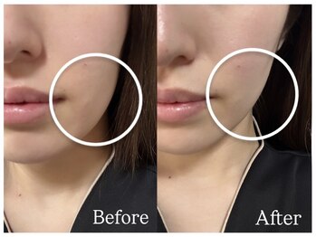 トノ(TONO)/before→after