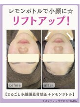 ティアラ(TIARA)/レモンボトル