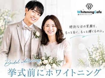 ホワイトニングカフェ 苫小牧店(WhiteningCafe)の写真/【前日駆け込み予約◎】1DAY完結ホワイトニング＊大切な日を白い歯で！結果重視＊歯科医監修ホワイトニング