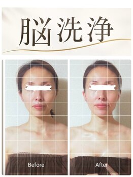 ファースト(first)の写真/    顔のむくみ・もたつきに。理想のすっきり小顔へ　脳洗浄　小顔矯正　コルギ　小顔ヘッドマッサージ
