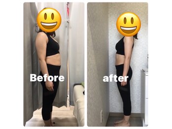 くまがい整体院 若松店/ビフォーアフター