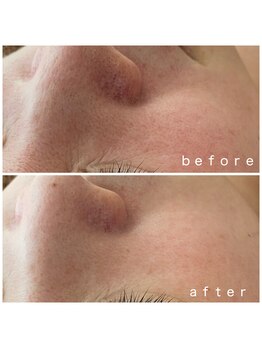 メナードフェイシャルサロン 岐阜茜部/美白、うるおい、毛穴ケア