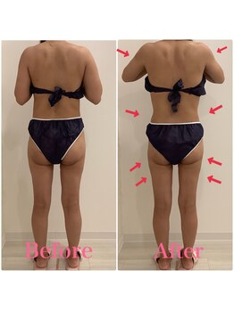 スペチアーレ 夙川/落ちにくい脂肪とサヨナラ