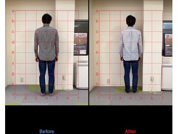 けいのき鍼灸整骨院/姿勢から身体を楽に!整体/肩こり