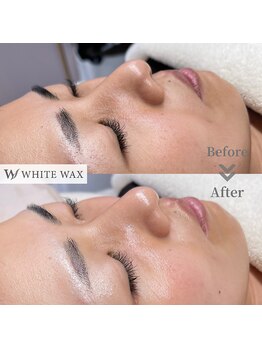 ホワイトワックス 浜松(WHITE WAX)/潤艶肌美人への道のり