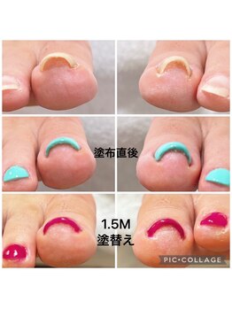 ミイア 春日部店(MiiA)/塗布直後から効果あり