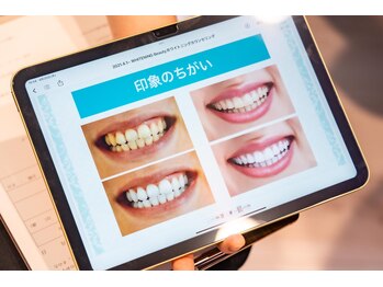 ホワイトニング ビューティー 南魚沼店(whitening beauty)/印象の違い