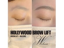 ウェリナ(welina)/