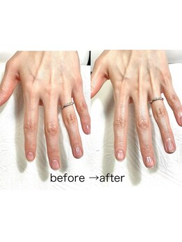 リンク(LINK)/ハンドエステ