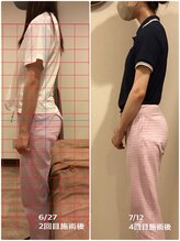 ヴィラ整骨院/反り腰の改善に◎