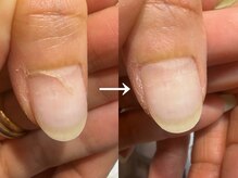 コフレ 千歳烏山(Coffret)/care