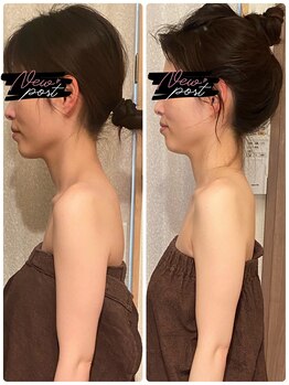 カイロプラクテックサロンドアール(Salon de R)の写真/挙式やブライダルフォトを控えている方に◎大切な日を綺麗な姿で迎えられるようサポートします♪