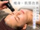 ルクサージュ(LUXAGE)の写真