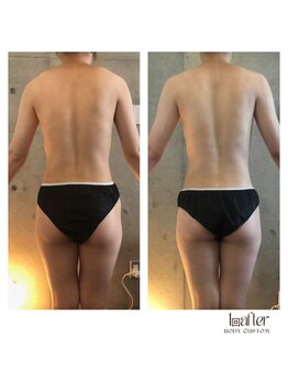 サプナジー(Suppnrgy)/カスタムトリートメント