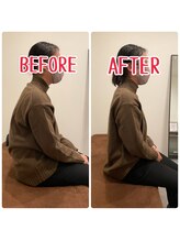 ジェイペック鍼灸整骨院/全身矯正ビフォアフ