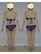 アルマ 芦屋(ALMA)/いつものお手入れにZERO G FREE!