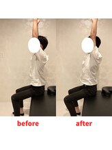 ナオル整体 福岡香椎院(NAORU整体)/20代男性施術事例【肩の痛み】