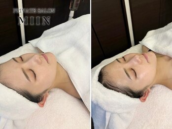 ミイン(miin)/韓国肌管理LHALALAララピール