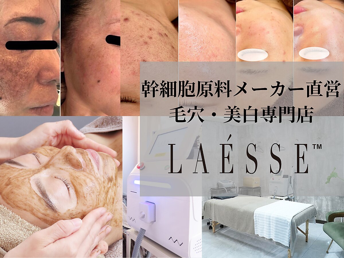 ラエッセ(LAESSE)｜ホットペッパービューティー