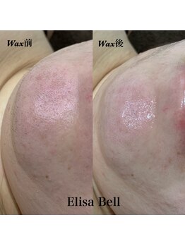 エリーザベル(Elisa Bell)/フェイシャルワックス脱毛