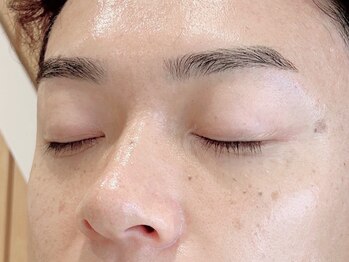 リボン(RiboN)/【メンズプレミアムコース】