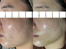 リボーン(REBORN)/お悩み解消・予防