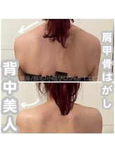 エピ(ep)/before→after