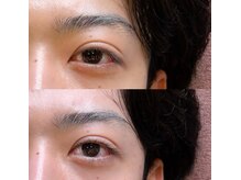 オーバイルッカ(O by RUCCA)/逆まつげ改善