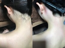 クラウン ジュエルズ(CROWN JEWELS)/うなじワックス