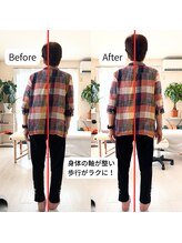 はやと整体院/７０代女性（腰痛）