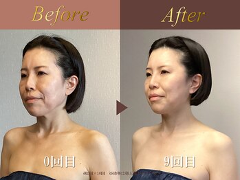 オーシャン(Ocean)/全身美容矯正120分/週1回×10回