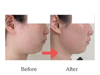 グラシア(gracia)/シミ・毛穴ケア専門店gracia