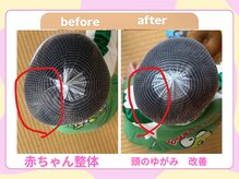 らくだ整骨院/赤ちゃん整体